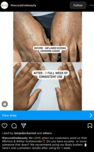 before and after client testimonial